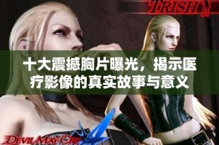 十大震撼胸片曝光，揭示医疗影像的真实故事与意义
